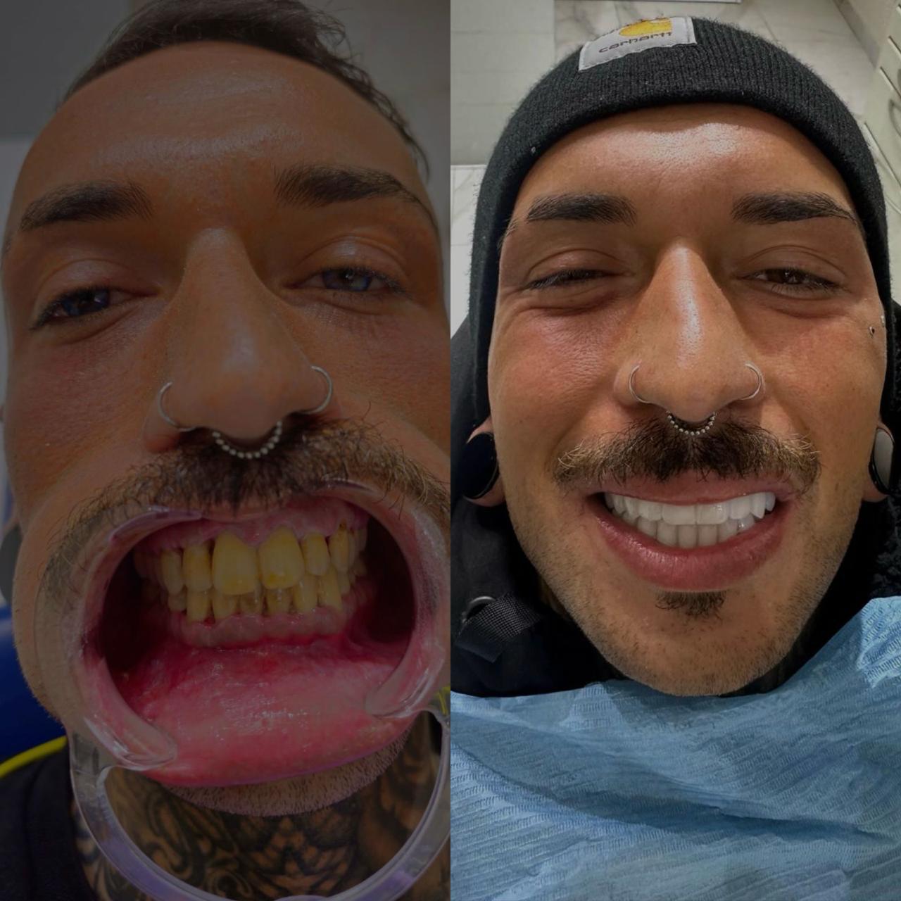 Prima e dopo Euro Medicalia